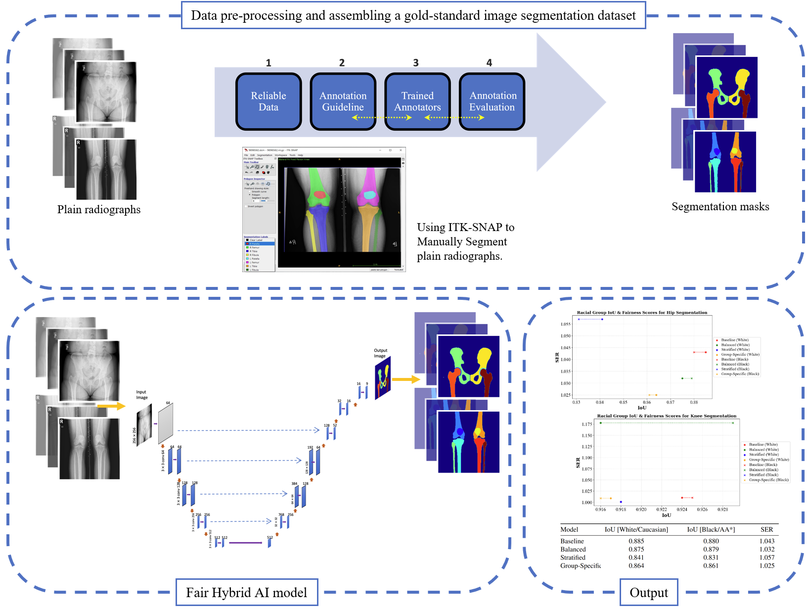 Advancing AI-Powered Orthopedic Image Segmentation: Mitigating Bias for Enhanced and Equitable Healthcare.